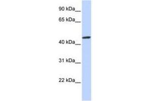Image no. 1 for anti-Zinc Finger Protein 239 (ZNF239) (AA 108-157) antibody (ABIN6740511)