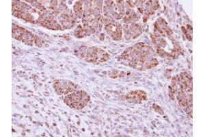 IHC-P Image Immunohistochemical analysis of paraffin-embedded NCIN87 xenograft, using DUSP7 , antibody at 1:100 dilution. (DUSP7 antibody  (C-Term))
