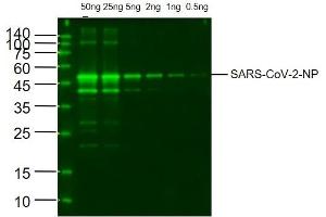 SARS-CoV-2 Nucleocapsid Protein at 0. (SARS-CoV-2 Nucleocapsid antibody)