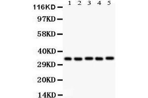 Western Blotting (WB) image for anti-Homeobox A11 (HOXA11) (AA 74-245) antibody (ABIN3042454)