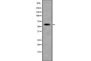 Western blot analysis of KCNN1 expression in Jurkat cell lysate ,The lane on the left is treated with the antigen-specific peptide. (KCNN1 antibody  (Internal Region))