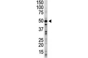 GSK3B antibody used in western blot to detect GSK3B in 293 cell lysate.