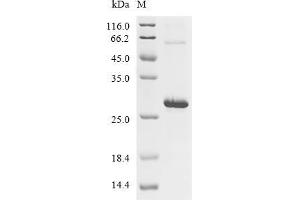 (Tris-Glycine gel) Discontinuous SDS-PAGE (reduced) with 5 % enrichment gel and 15 % separation gel.