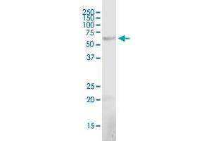 CRAT polyclonal antibody (A01). (CRAT antibody  (AA 445-544))
