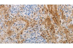 Immunohistochemistry of paraffin-embedded Human tonsil using NGFR Polyclonal Antibody at dilution of 1:50 (NGFR antibody)