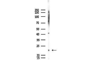 anti-FCF1 Small Subunit (SSU) Processome Component Homolog (FCF1) antibody