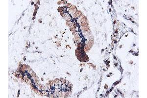 Image no. 3 for anti-IlvB (Bacterial Acetolactate Synthase)-Like (ILVBL) antibody (ABIN1498878)