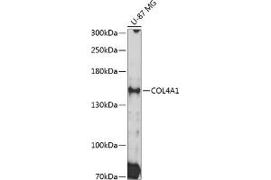 Western blot analysis of extracts of U-87 MG cells, using COL4 Antibody (0710) at 1:3000 dilution.