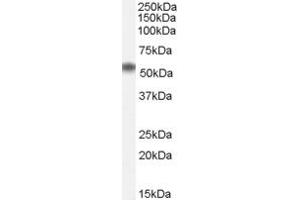 Western Blotting (WB) image for anti-ELMO/CED-12 Domain Containing 1 (ELMOD1) (N-Term) antibody (ABIN2787155) (ELMOD1 antibody  (N-Term))