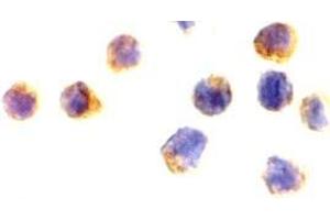 Immunocytochemistry of AIF? (AIF antibody  (N-Term))