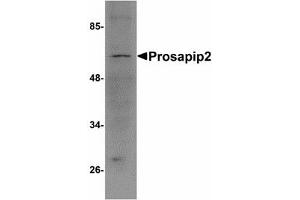 Image no. 1 for anti-TBK1 Binding Protein 1 (TBKBP1) (C-Term) antibody (ABIN478165)