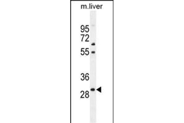 PHOX2B Antikörper  (AA 104-130)