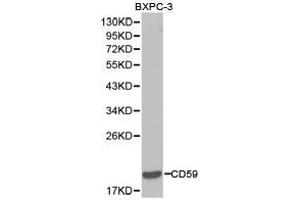 Western Blotting (WB) image for anti-CD59 (CD59) antibody (ABIN1871644) (CD59 antibody)