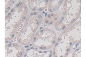Detection of TMEM27 in Human Kidney Tissue using Monoclonal Antibody to Transmembrane Protein 27 (TMEM27) (TMEM27 antibody  (AA 17-137))