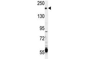 TRPM6 antibody western blot analysis in CEM lysate