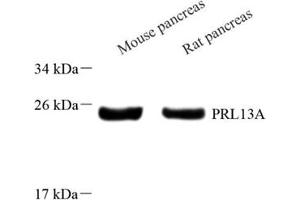 Western blot analysis of RPL13A (ABIN7075430) at dilution of 1: 800