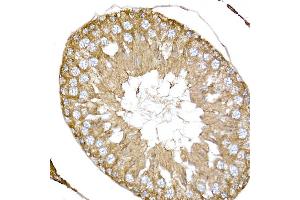 Immunohistochemistry of paraffin-embedded rat testis using NPHP1 Rabbit pAb (ABIN6128349, ABIN6144768, ABIN6144769 and ABIN6222377) at dilution of 1:50 (40x lens). (NPHP1 antibody  (AA 345-614))