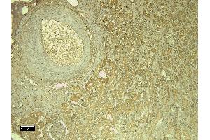 Immunohistochemistry (IHC) image for anti-Leptin Receptor (LEPR) (Internal Region) antibody (ABIN185639)
