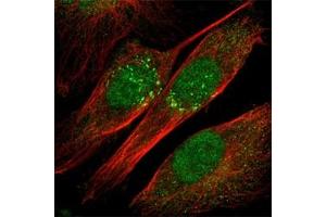 Immunofluorescence staining of U-251MG cell line with antibody shows positivity in nucleus and Golgi apparatus(green).
