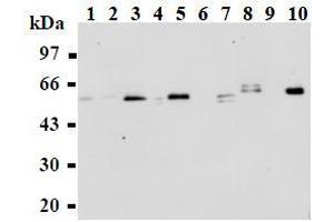 Western Blotting (WB) image for anti-Abl-Interactor 1 (ABI1) antibody (ABIN1449186)
