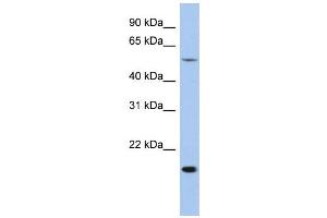 WB Suggested Anti-TEAD2 Antibody Titration: 0. (TEAD2 antibody  (Middle Region))