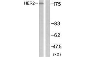 Western blot analysis of extracts from SK-OV3 cells, using HER2 (Ab-1221/1222) Antibody. (ErbB2/Her2 antibody  (AA 1191-1240))