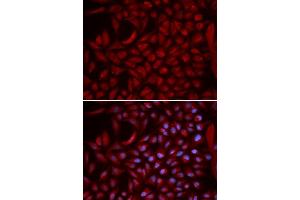 Immunofluorescence analysis of U2OS cells using CUL5 antibody (ABIN5973105). (Cullin 5 antibody)
