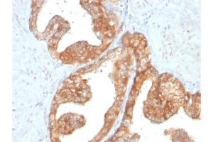 Immunohistochemistry (IHC) image for anti-Ret Proto-Oncogene (RET) (AA 702-848) antibody (ABIN6940507)