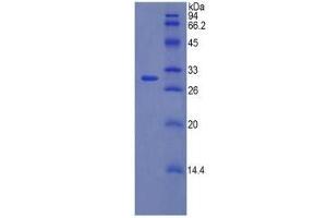 Western Blotting (WB) image for Coagulation Factor V (F5) ELISA Kit (ABIN6574187)