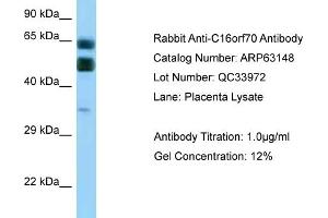 Western Blotting (WB) image for anti-Chromosome 16 Open Reading Frame 70 (C16orf70) (C-Term) antibody (ABIN2789391) (C16orf70 antibody  (C-Term))