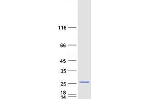 Validation with Western Blot (C9ORF85 Protein (Myc-DYKDDDDK Tag))
