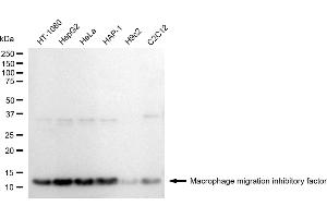 anti-Macrophage Migration Inhibitory Factor (Glycosylation-Inhibiting Factor) (MIF) antibody