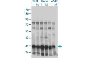 Western blot analysis of HMG20B in extracts from 293T, HeLa and A549 cell using anti-HMG20B monoclonal antibody.
