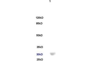 Human colon carcinoma lysate 30ug, probed (ABIN749678) at 1:200 overnight in 4 °C. (TREM2 antibody  (AA 1-100))