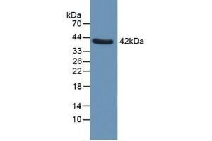 Detection of QPCT in Human Uterus using Polyclonal Antibody to Glutaminyl Peptide Cyclotransferase (QPCT) (QPCT antibody  (AA 29-361))