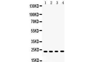 Anti-RBP4 Picoband antibody, Western blotting All lanes: Anti RBP4  at 0. (RBP4 antibody  (AA 19-201))