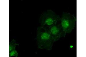 Immunofluorescence (IF) image for anti-alpha-Fetoprotein (AFP) (AA 19-397) antibody (ABIN2716009) (alpha Fetoprotein antibody  (AA 19-397))
