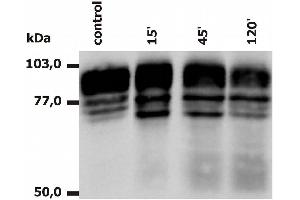 Western Blotting analysis of PMA-activated neutrophils (Fig. (Integrin beta 2 antibody  (APC))