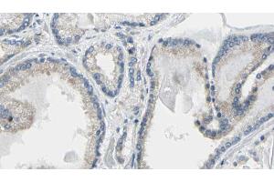 ABIN6274218 at 1/100 staining Human prostate tissue by IHC-P. (Calreticulin antibody  (N-Term))