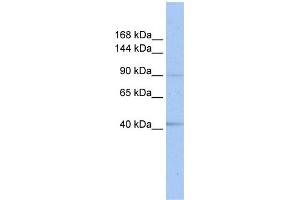 WB Suggested Anti-SENP6  Antibody Titration: 0. (SENP6 antibody  (C-Term))