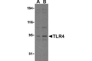 Western Blotting (WB) image for anti-Toll-Like Receptor 4 (TLR4) (N-Term) antibody (ABIN1031622) (TLR4 antibody  (N-Term))