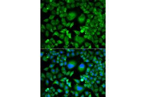 Immunofluorescence analysis of A549 cells using UBE2H antibody (ABIN4905537).