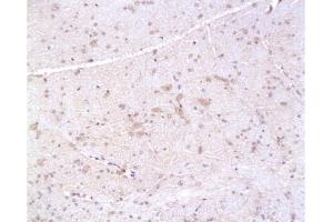 Formalin-fixed and paraffin embedded: rat brain tissue labeled with Anti-PMP22 Polyclonal Antibody, Unconjugated  at 1:200, followed by conjugation to the secondary antibody and DAB staining (PMP22 antibody  (AA 101-160))