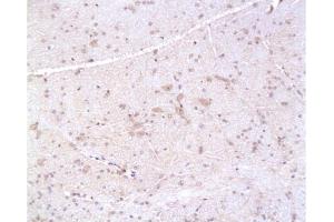 Formalin-fixed and paraffin embedded: rat brain tissue labeled with Anti-PMP22 Polyclonal Antibody, Unconjugated  at 1:200, followed by conjugation to the secondary antibody and DAB staining
