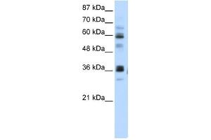 RPUSD2 antibody used at 5 ug/ml to detect target protein. (RPUSD2 antibody  (N-Term))