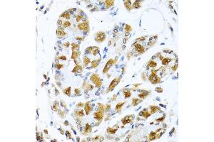 Immunohistochemistry of paraffin-embedded human stomach using PIAS3 antibody at dilution of 1:100 (40x lens). (PIAS3 antibody)