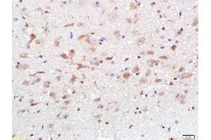 Paraformaldehyde-fixed, paraffin embedded (Species/Tissue), Antigen retrieval by boiling in sodium citrate buffer (pH6) for 15min, Block endogenous peroxidase by 3% hydrogen peroxide for 30 minutes, Blocking buffer (normal goat serum) at 37°C for 20min, Antibody incubation with Calcium Sensing Receptor Polyclonal Antibody, Unconjugated  at 1:500 overnight at 4°C, followed by a conjugated secondary and DAB staining. (CASR antibody  (AA 121-220))
