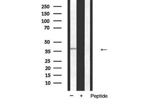 Western blot analysis of ANX expression in K562 cells