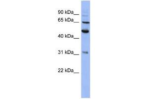 WB Suggested Anti-PSMD3 Antibody Titration: 0. (PSMD3 antibody  (N-Term))