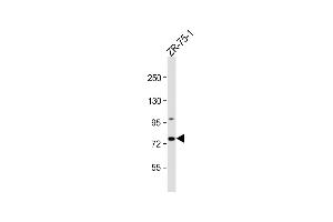 Anti-CTTNBP2NL Antibody (N-term) at 1:1000 dilution + ZR-75-1 whole cell lysate Lysates/proteins at 20 μg per lane. (CTTNBP2NL antibody  (N-Term))